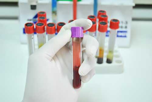 Phlebotomy Technician Education and Training